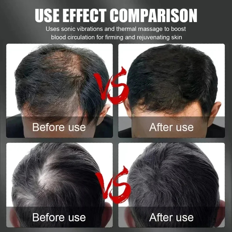 660nm 850nm Red Light Infrared - Hair Care 评论和价格